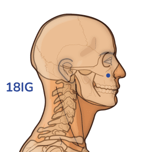 Quanliao - Punto de acupuntura 18IG - Meridiano del intestino delgado