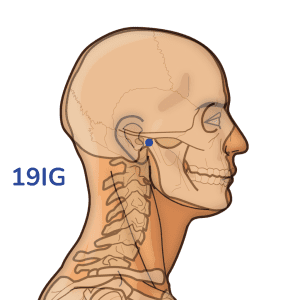 Tinggong - Punto de acupuntura 19IG - Meridiano del intestino delgado