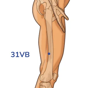 Fengshi - Punto de acupuntura 31VB - Meridiano de la vesícula biliar