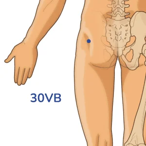 Huantiao - Punto de acupuntura 30VB - Meridiano de la vesícula biliar