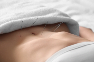 Acupuncture ventre