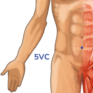 ShiMen- Point d'acupuncture 5VC - Méridien vaisseau Conception