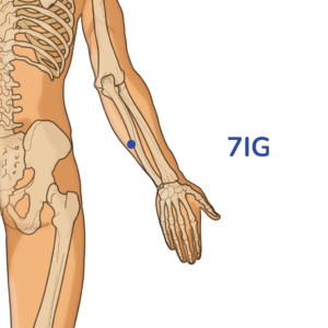 Zhizheng - Point d'acupuncture 7IG - Méridien de l'Intestin Grêle